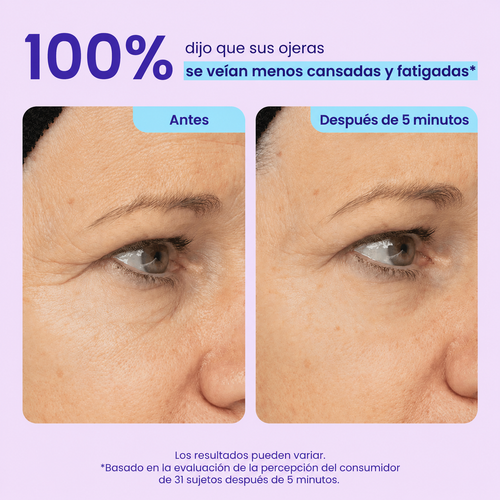 Instant Smoothing Eye Contour Gel