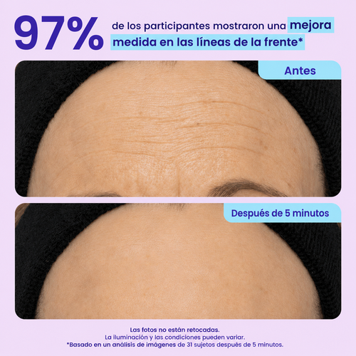 Instant Smoothing Eye Contour Gel