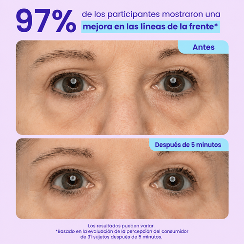 Instant Smoothing Eye Contour Gel
